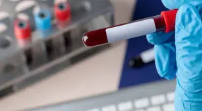 Trasplante logra eliminar el VIH en paciente; ya suman 10 casos