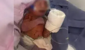 Abandonan a recién nacida en Ecatepec; fue hallada en una bolsa negra con signos de hipotermia