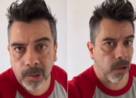 Carlos Espejel sufre parálisis facial y hace pausa en su carrera