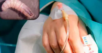 Atienden 20 nuevos casos de gusano barrenador en Yucatán