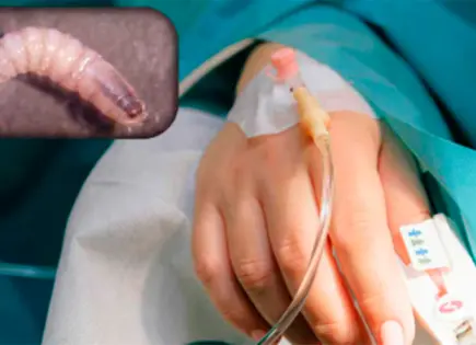 Reportan 33 casos de miasis por gusano barrenador en Chiapas y Campeche