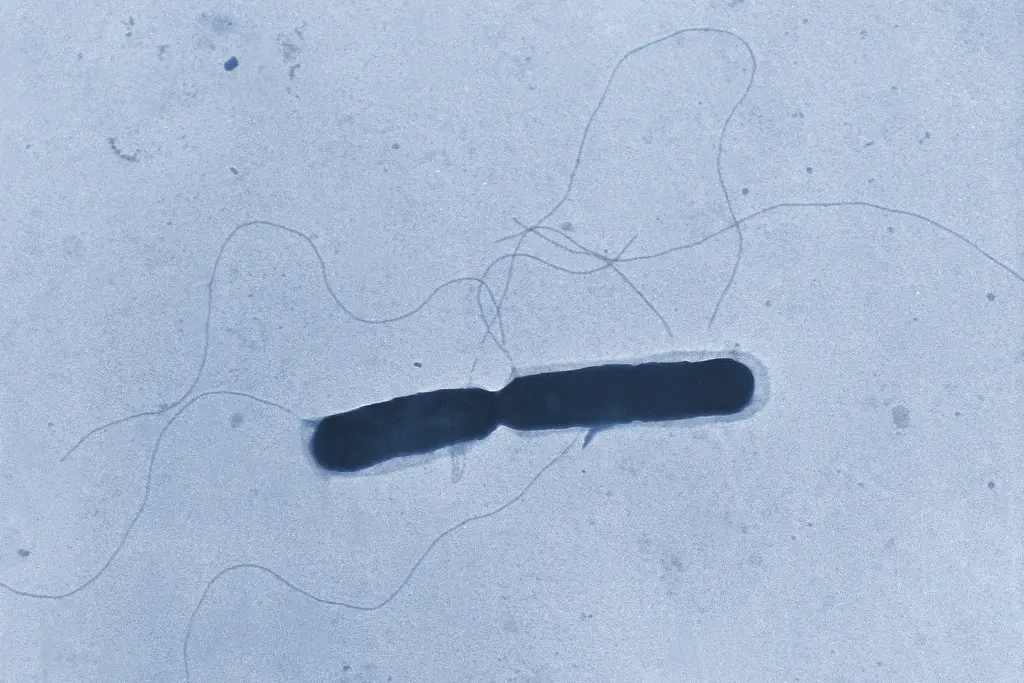 Brote mortal de listeria vinculado a fettuccini alfredo de pollo en Kroger y Walmart