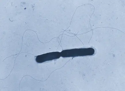 Brote mortal de listeria vinculado a fettuccini alfredo de pollo en Kroger y Walmart