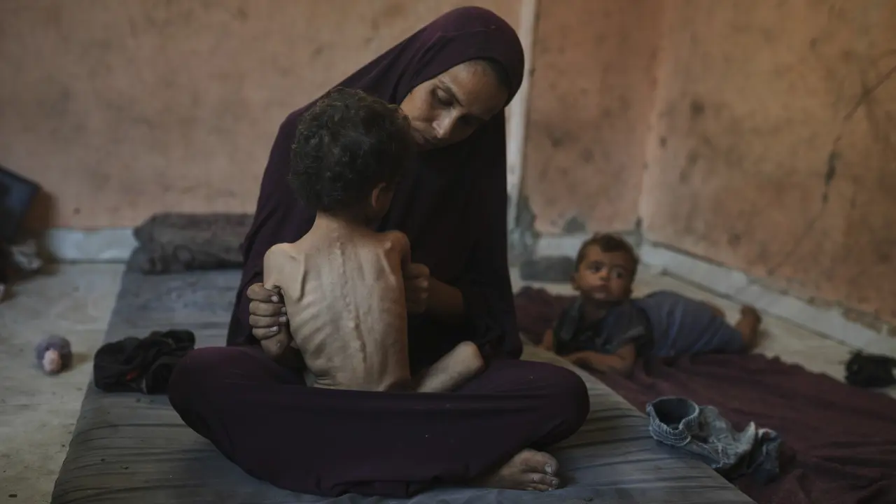 Decenas de niños en Gaza han muerto de hambre en un mes