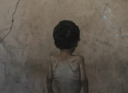 Aumento de desnutrición infantil en Gaza por crisis de hambre