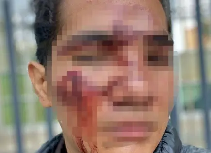 Denuncian ante FGE y CEDH brutal golpiza en el Toxic