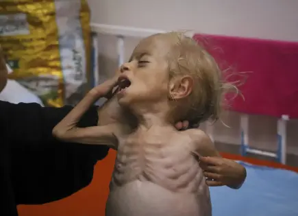 Desnutrición infantil en Gaza: Un drama que impacta a los más vulnerables