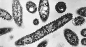 Brote legionelosis suma 4 muertos en NY; hay otros 76 casos Brote legionelosis suma 4 muertos en NY; hay otros 76 casos