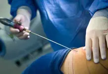 Mujer fallece durante cirugía estética, ahora en Chiapas