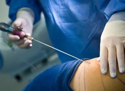 Mujer fallece durante cirugía estética, ahora en Chiapas