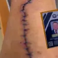Agente de FGE, denunciado por golpiza a expareja