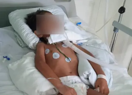 Negligencia en el IMSS deja con graves secuelas a menor