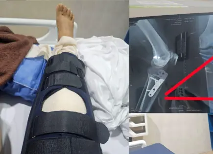 Sufre fracturas tras embestida de borrego en el Tangamanga I