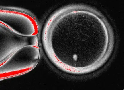 Avance científico: Células de piel humana utilizadas para crear óvulos fertilizables Avance científico: Células de piel humana utilizadas para crear óvulos fertilizables