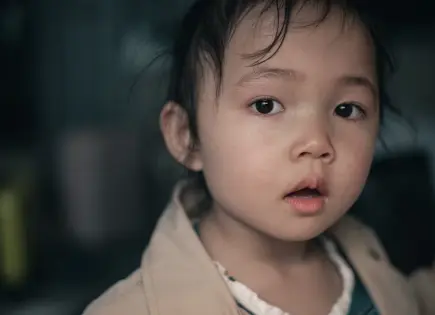 ¿Qué es el síndrome de Kabuki? Conoce sus principales síntomas