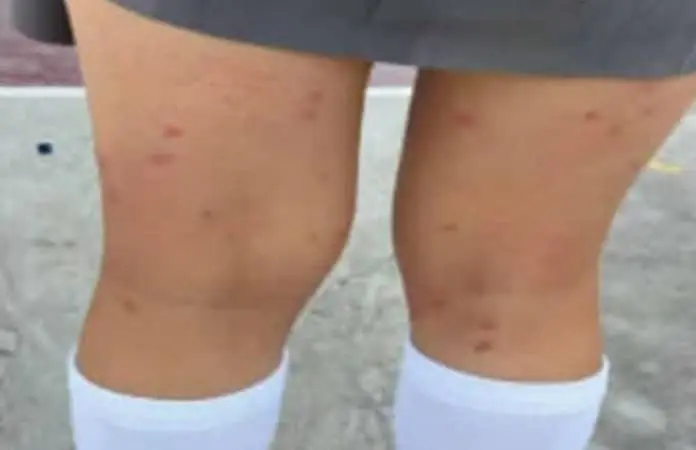 Exigen fumigar instalaciones del CBTIS