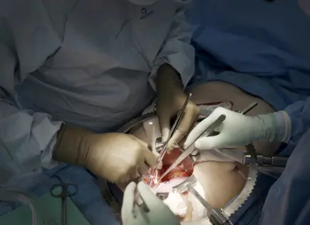 Comienza el primer ensayo clínico de trasplantes de riñón de cerdo