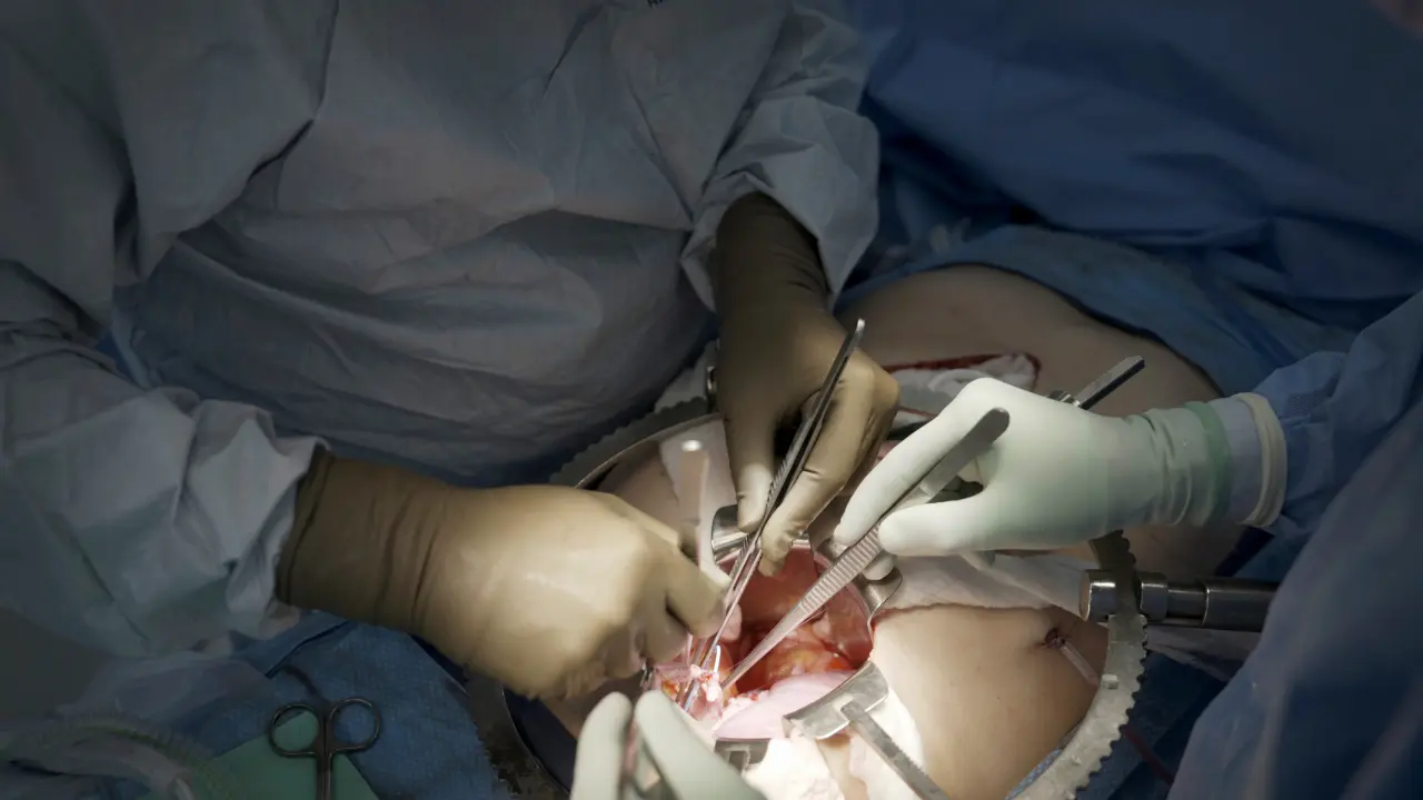 Comienza ensayo clínico de trasplante de riñones de cerdo en Estados Unidos