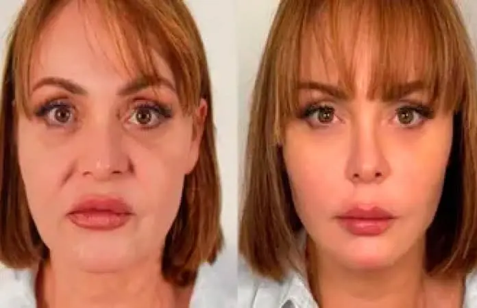 Gaby Spanic y su nuevo rostro
