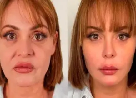 Gaby Spanic y su nuevo rostro