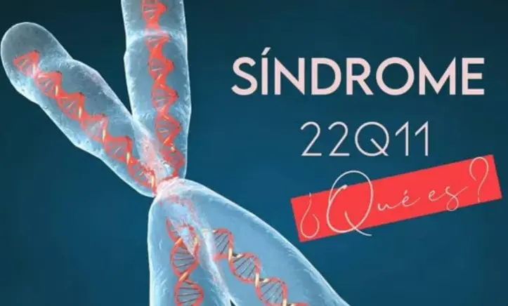¿Qué es el síndrome 22q11 qué se conmemora el 22 de noviembre?