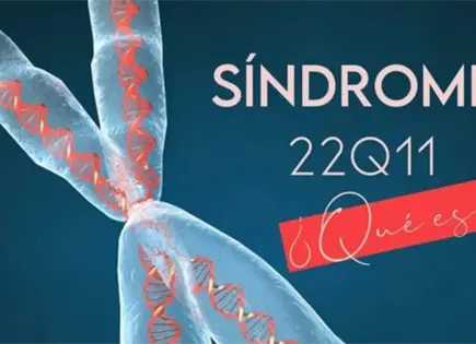 ¿Qué es el síndrome 22q11 qué se conmemora el 22 de noviembre?