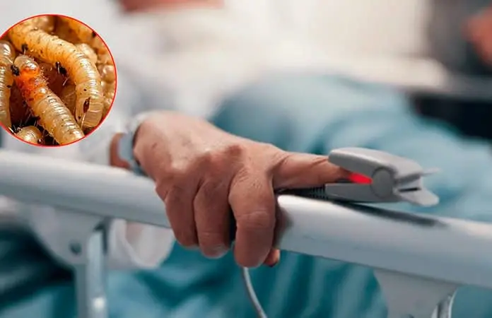 Otro caso humano de gusano barrenador