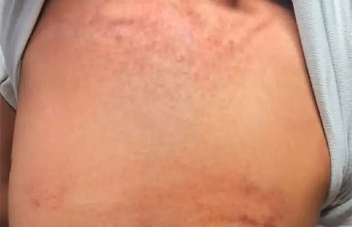 Docentes denuncian a padre golpeador