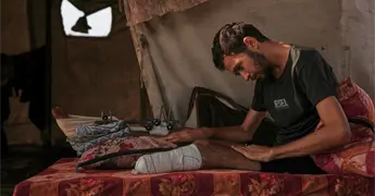 Escasez de pr&oacute;tesis y tratamientos m&eacute;dicos en Gaza post-bombardeos