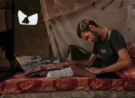 Escasez de prótesis y tratamientos médicos en Gaza post-bombardeos Escasez de prótesis y tratamientos médicos en Gaza post-bombardeos