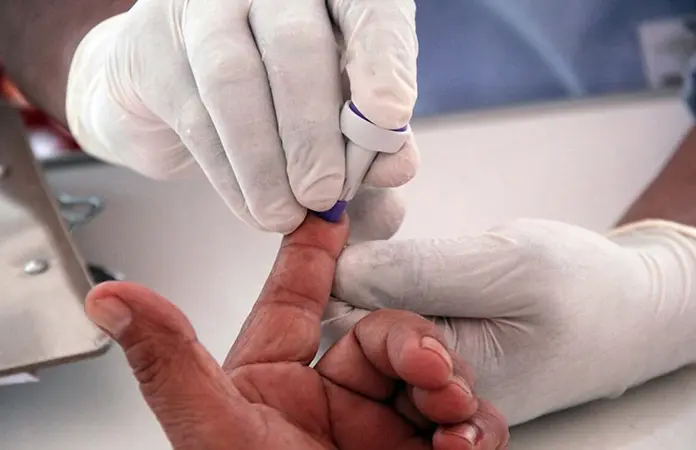 Casi 300 nuevos casos de VIH en Yucatán