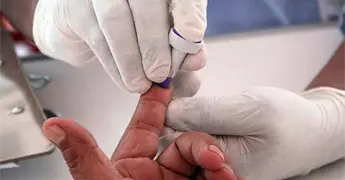 Casi 300 nuevos casos de VIH en Yucat&aacute;n