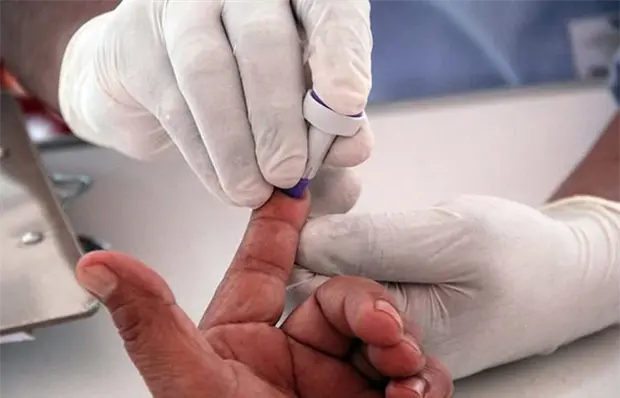 Baja n&uacute;mero de personas con diagn&oacute;stico de VIH