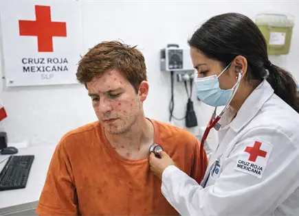 Entérate | ¿Cómo saber si tienes sarampión? Entérate | ¿Cómo saber si tienes sarampión?