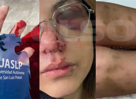 Denuncian a profesor de la UASLP por agresi&oacute;n a alumna