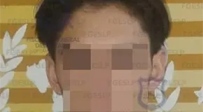 Aseguran a sujeto por homicidio en Las Camelias