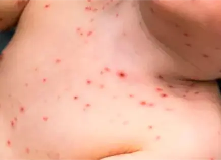 La vacunaci&oacute;n no llega a la Monta&ntilde;a de Guerrero