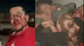 Ebrio desata agresi&oacute;n contra polic&iacute;as en Villa Alborada