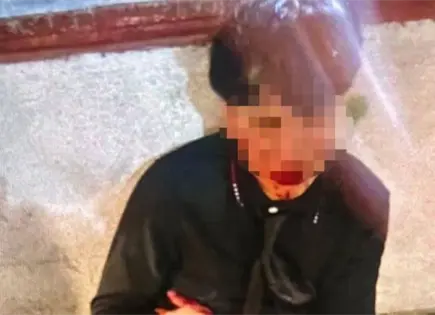 Operativo en la Becene tras agresi&oacute;n a joven con arma blanca