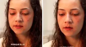 Española con encefalomielitis severa accede a eutanasia Española con encefalomielitis severa accede a eutanasia