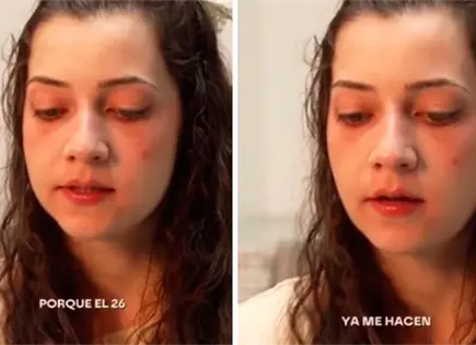 Joven espa&ntilde;ola con encefalomielitis severa accede a eutanasia en Catalu&ntilde;a