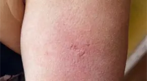 Lideresa de artesanos agrede a exrepresentante