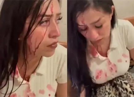 Sepiver enfrenta acusaci&oacute;n por golpiza en el Hospital Central