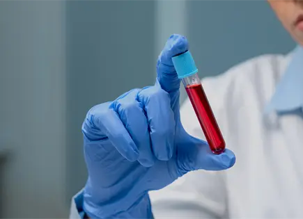 Detectan plomo en sangre de 329 menores en Cendis de NL