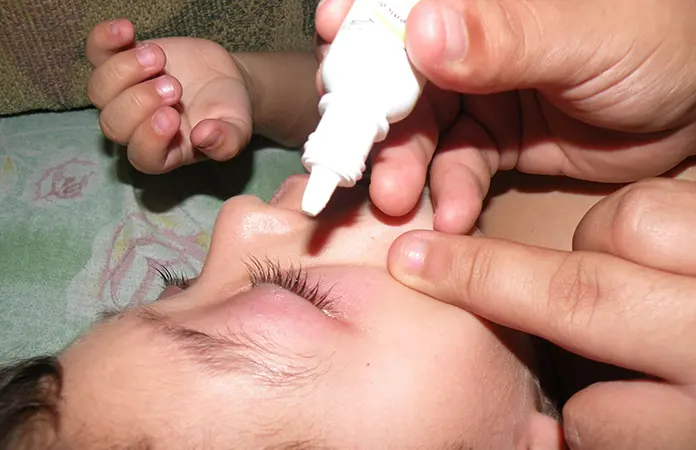 Alertan sobre incremento de conjuntivitis