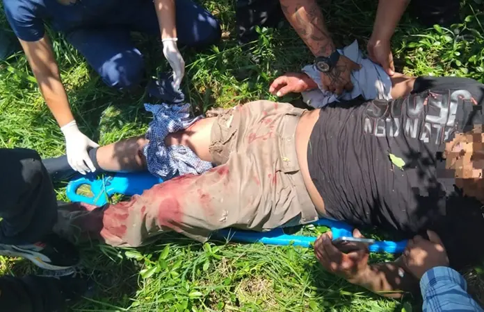 Se recupera, hombre mordido por cocodrilo