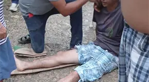 Motociclista se rompe una pierna en caída