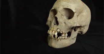 Cient&iacute;ficos hallan peste m&aacute;s antigua en Siberia: ADN en restos humanos