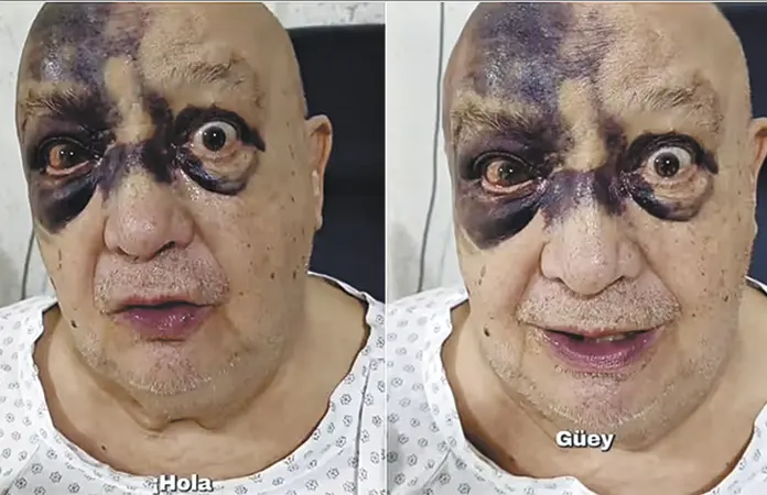 LUIS DE ALBA SUFRE ACCIDENTE
