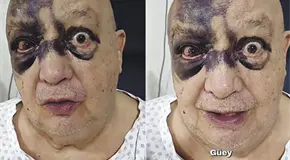 LUIS DE ALBA SUFRE ACCIDENTE